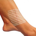 Sutures Cutanées Adhésives...